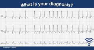 What is your diagnosis?

a.	Sinus rhythm
b.	Atrial fibrillation
c.	Supraventricular tachycardia
d.	Ventricular tachycardia

Would you like more support with interpreting your ECGs? 

Would you like help with a suitable treatment plan for your cases of arrhythmia?

Our experienced and friendly specialist cardiology team can support your with all aspects of diagnosis, treatment and ongoing management.

Get in touch by emailing info@vvs.vet or visit www.vvs.vet for more information. 

The correct answer is.....

b.	Atrial fibrillation 

Atrial fibrillation is usually characterised by a fast heart rate, irregular rhythm and absence of P waves. In this ECG, the HR is 170 bpm, the R-R intervals are extremely variable and there are no obvious P waves – this is consistent with atrial fibrillation.
 
#veterinarycardiology #vetcardio #vetcpd #clinicalconundrum #veterinarycpd #virtualvet #vvs #vetsupport #virtualsupport #virtualspecialist #veterinaryspecialist #veterinaryreferral #virtualreferral